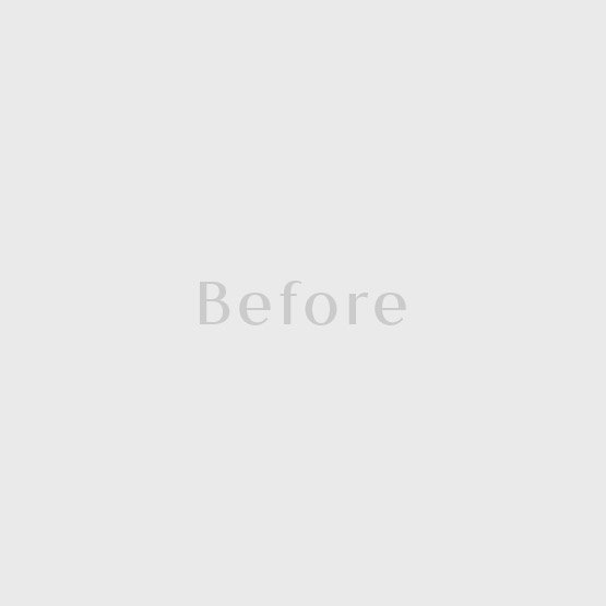 Before Juvelook Volume